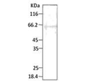 Western Blot - Anti-HSP40 Antibody (A304743) - Antibodies.com