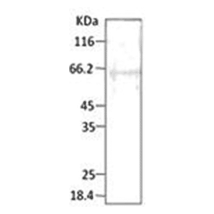 Western Blot - Anti-HSP40 Antibody (A304743) - Antibodies.com