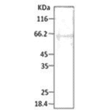 Western Blot - Anti-HSP40 Antibody (A304743) - Antibodies.com