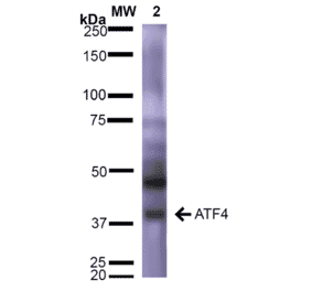 Western Blot - Anti-ATF4 Antibody [S360A-24] (A304745) - Antibodies.com