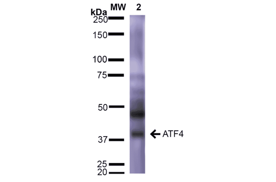 Western Blot - Anti-ATF4 Antibody [S360A-24] (A304745) - Antibodies.com