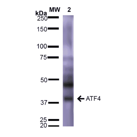 Western Blot - Anti-ATF4 Antibody [S360A-24] (A304745) - Antibodies.com