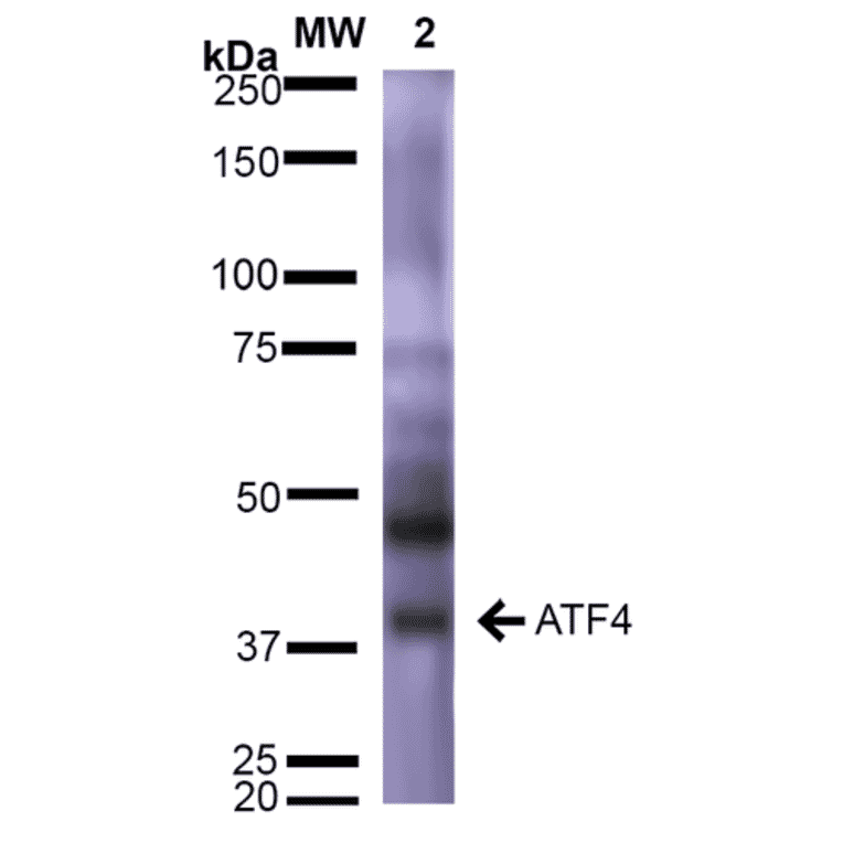 Western Blot - Anti-ATF4 Antibody [S360A-24] (A304745) - Antibodies.com