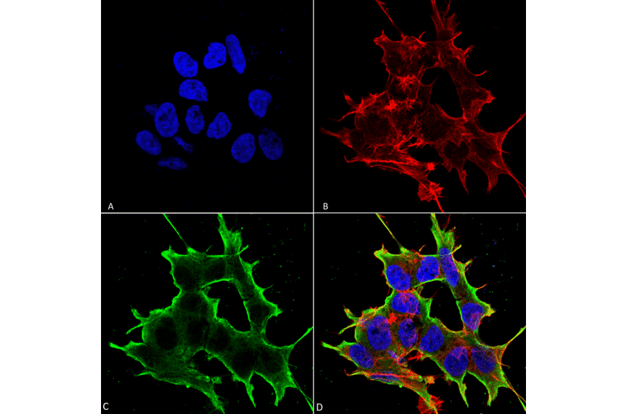 Immunocytochemistry/Immunofluorescence - Anti-ATF4 Antibody [S360A-24] (A304745) - Antibodies.com