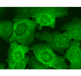Immunocytochemistry/Immunofluorescence - Anti-CACNB2 Antibody [N8b/1] (A304748) - Antibodies.com