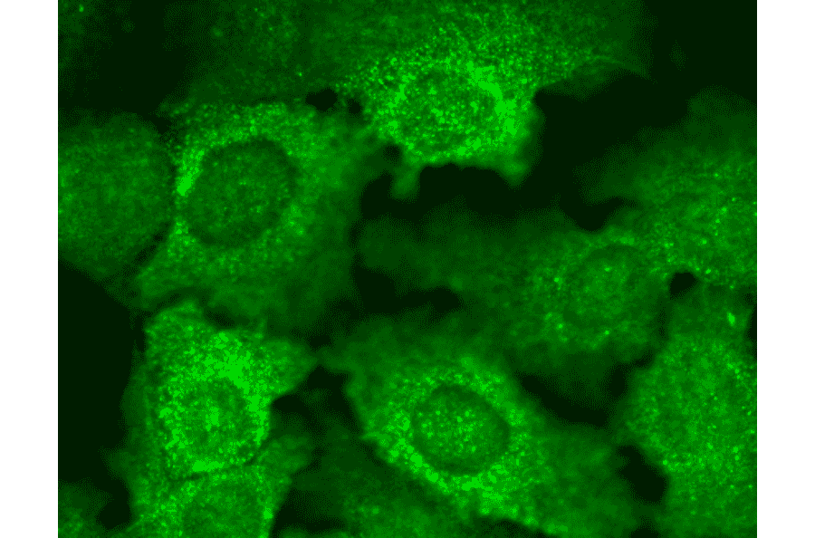 Immunocytochemistry/Immunofluorescence - Anti-CACNB2 Antibody [N8b/1] (A304748) - Antibodies.com
