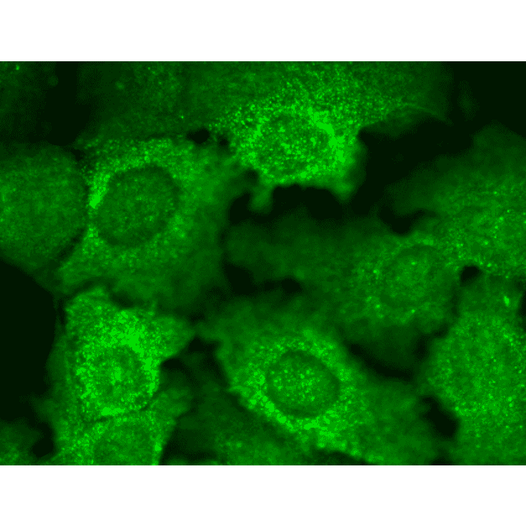 Immunocytochemistry/Immunofluorescence - Anti-CACNB2 Antibody [N8b/1] (A304748) - Antibodies.com