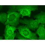 Immunocytochemistry/Immunofluorescence - Anti-CACNB2 Antibody [N8b/1] (A304748) - Antibodies.com