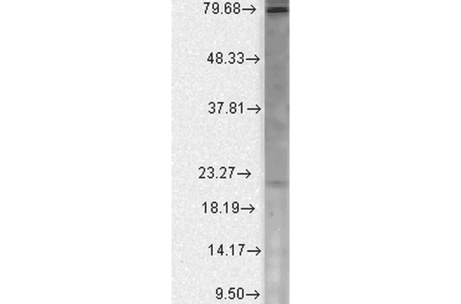 Western Blot - Anti-CACNB2 Antibody [N8b/1] (A304748) - Antibodies.com