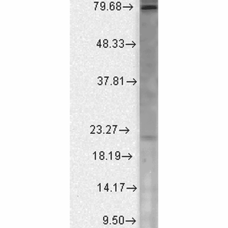 Western Blot - Anti-CACNB2 Antibody [N8b/1] (A304748) - Antibodies.com