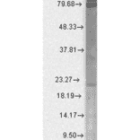 Western Blot - Anti-CACNB2 Antibody [N8b/1] (A304748) - Antibodies.com