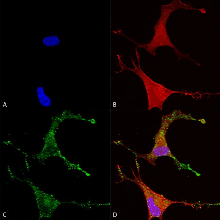 Immunocytochemistry/Immunofluorescence - Anti-CACNB2 Antibody [N8b/1] (A304748) - Antibodies.com