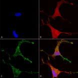 Immunocytochemistry/Immunofluorescence - Anti-CACNB2 Antibody [N8b/1] (A304748) - Antibodies.com