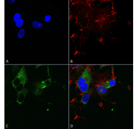 Immunocytochemistry/Immunofluorescence - Anti-Cav1.3 Antibody [S48] (A304749) - Antibodies.com