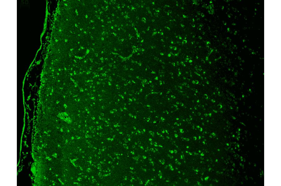 Immunohistochemistry - Anti-Cav1.3 Antibody [S48] (A304749) - Antibodies.com