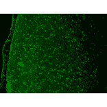 Immunohistochemistry - Anti-Cav1.3 Antibody [S48] (A304749) - Antibodies.com