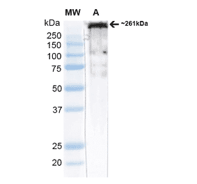 Western Blot - Anti-CACNA1H Antibody [N55/10] (A304750) - Antibodies.com