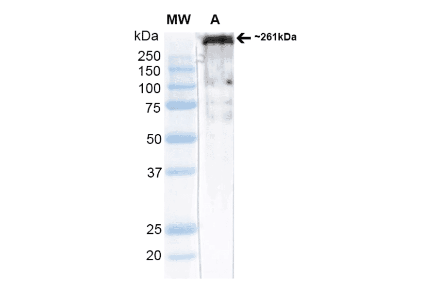 Western Blot - Anti-CACNA1H Antibody [N55/10] (A304750) - Antibodies.com