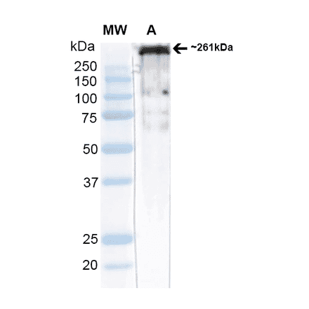 Western Blot - Anti-CACNA1H Antibody [N55/10] (A304750) - Antibodies.com