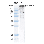 Western Blot - Anti-CACNA1H Antibody [N55/10] (A304750) - Antibodies.com
