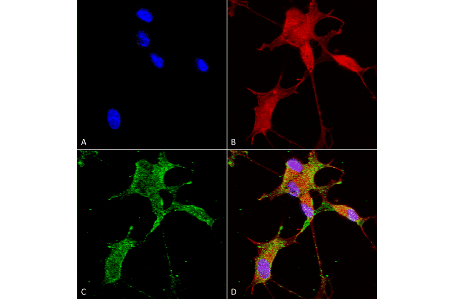 Immunocytochemistry/Immunofluorescence - Anti-CACNA1H Antibody [N55/10] (A304750) - Antibodies.com