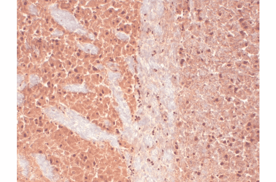 Immunohistochemistry - Anti-CACNA1H Antibody [N55/10] (A304750) - Antibodies.com