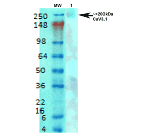 Western Blot - Anti-CACNA1G Antibody [S178A-9] (A304751) - Antibodies.com