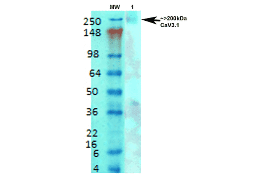 Western Blot - Anti-CACNA1G Antibody [S178A-9] (A304751) - Antibodies.com