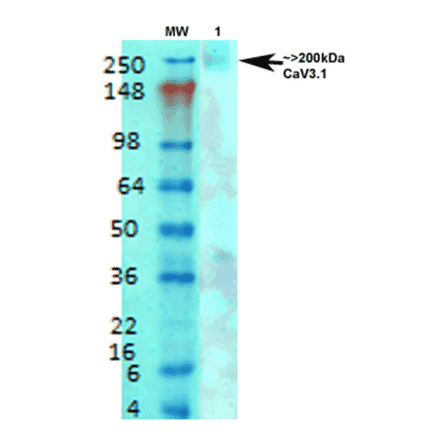 Western Blot - Anti-CACNA1G Antibody [S178A-9] (A304751) - Antibodies.com