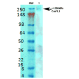 Western Blot - Anti-CACNA1G Antibody [S178A-9] (A304751) - Antibodies.com