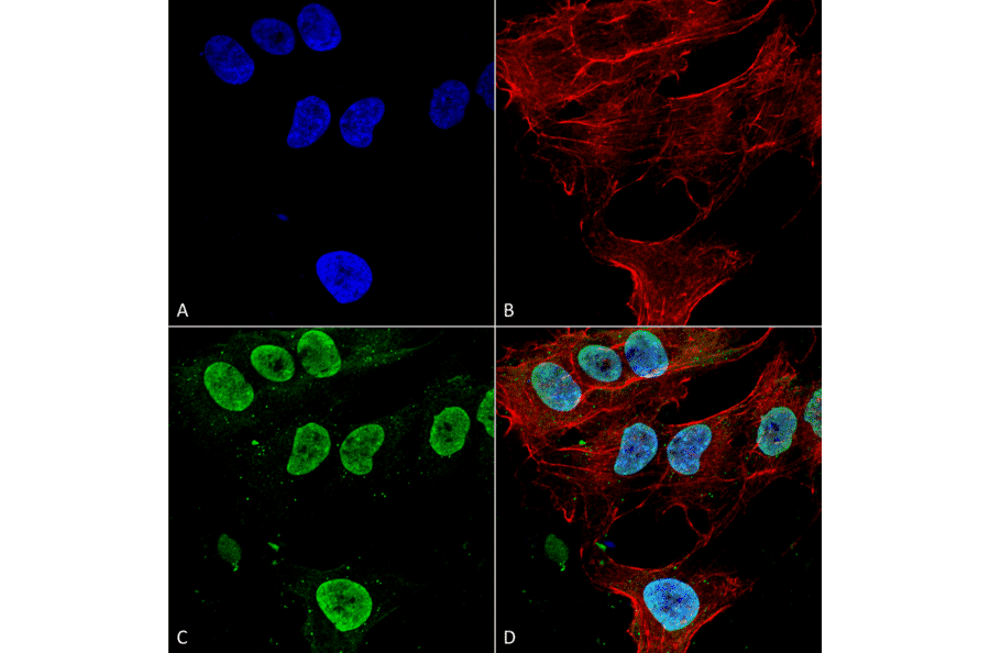 Immunocytochemistry/Immunofluorescence - Anti-CACNA1G Antibody [S178A-9] (A304751) - Antibodies.com
