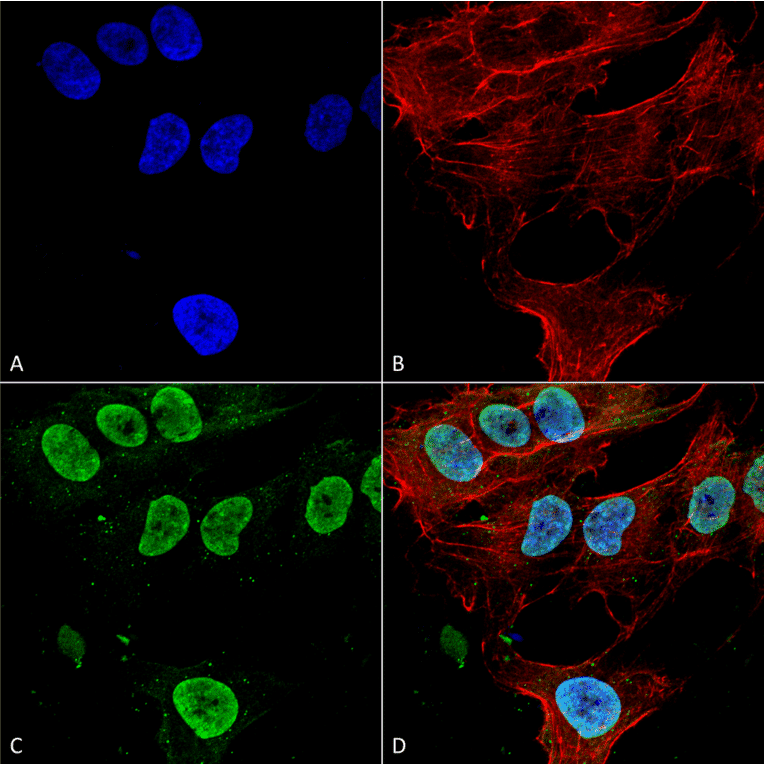 Immunocytochemistry/Immunofluorescence - Anti-CACNA1G Antibody [S178A-9] (A304751) - Antibodies.com
