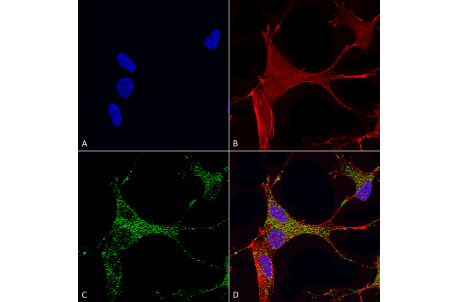 Immunocytochemistry/Immunofluorescence - Anti-CACNA1G Antibody [S178A-9] (A304751) - Antibodies.com