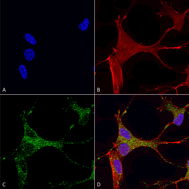 Immunocytochemistry/Immunofluorescence - Anti-CACNA1G Antibody [S178A-9] (A304751) - Antibodies.com
