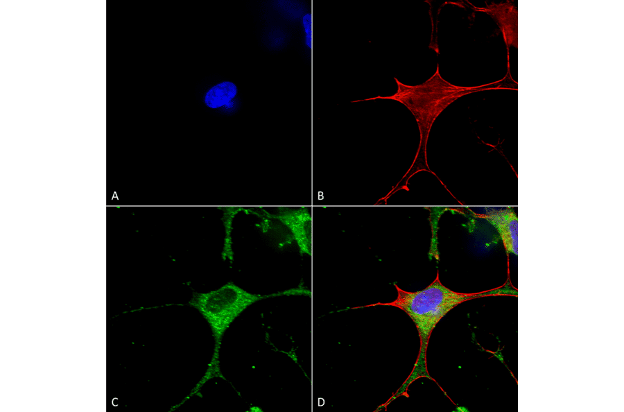 Immunocytochemistry/Immunofluorescence - Anti-CLC3 Antibody [S258-5] (A304752) - Antibodies.com