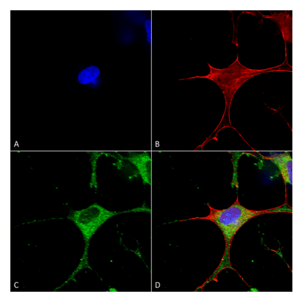 Immunocytochemistry/Immunofluorescence - Anti-CLC3 Antibody [S258-5] (A304752) - Antibodies.com