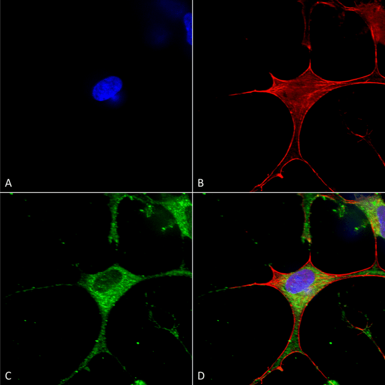Immunocytochemistry/Immunofluorescence - Anti-CLC3 Antibody [S258-5] (A304752) - Antibodies.com