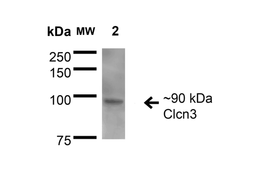 Western Blot - Anti-CLC3 Antibody [S258-5] (A304752) - Antibodies.com