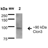 Western Blot - Anti-CLC3 Antibody [S258-5] (A304752) - Antibodies.com
