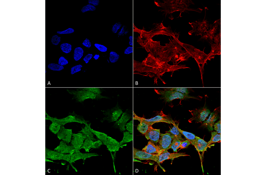 Immunocytochemistry/Immunofluorescence - Anti-CLC3 Antibody [S258-5] (A304752) - Antibodies.com