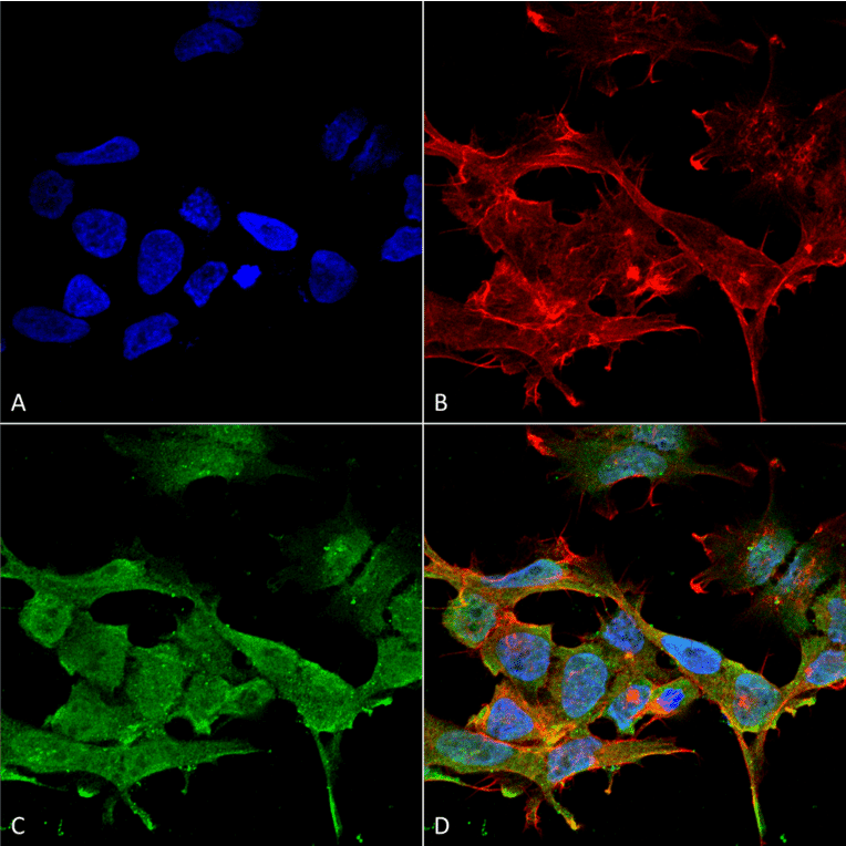 Immunocytochemistry/Immunofluorescence - Anti-CLC3 Antibody [S258-5] (A304752) - Antibodies.com