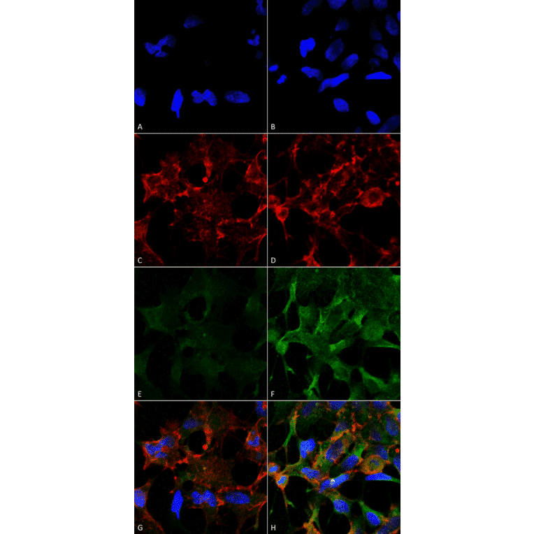 Immunocytochemistry/Immunofluorescence - Anti-Acrolein Antibody [2H2] (A304754) - Antibodies.com