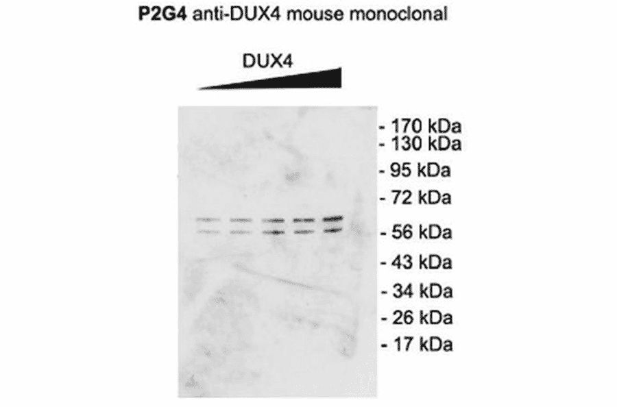Western Blot - Anti-DUX4 Antibody [P2B1] (A304755) - Antibodies.com