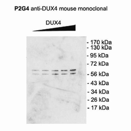 Western Blot - Anti-DUX4 Antibody [P2B1] (A304755) - Antibodies.com