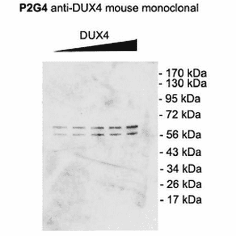 Western Blot - Anti-DUX4 Antibody [P2B1] (A304755) - Antibodies.com