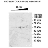 Western Blot - Anti-DUX4 Antibody [P2B1] (A304755) - Antibodies.com