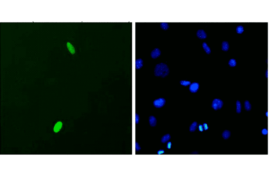 Immunocytochemistry/Immunofluorescence - Anti-DUX4 Antibody [P2B1] (A304755) - Antibodies.com