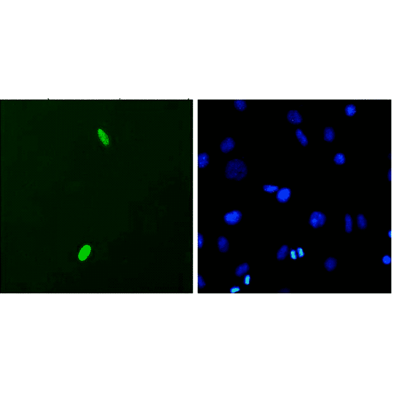 Immunocytochemistry/Immunofluorescence - Anti-DUX4 Antibody [P2B1] (A304755) - Antibodies.com