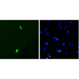 Immunocytochemistry/Immunofluorescence - Anti-DUX4 Antibody [P2B1] (A304755) - Antibodies.com