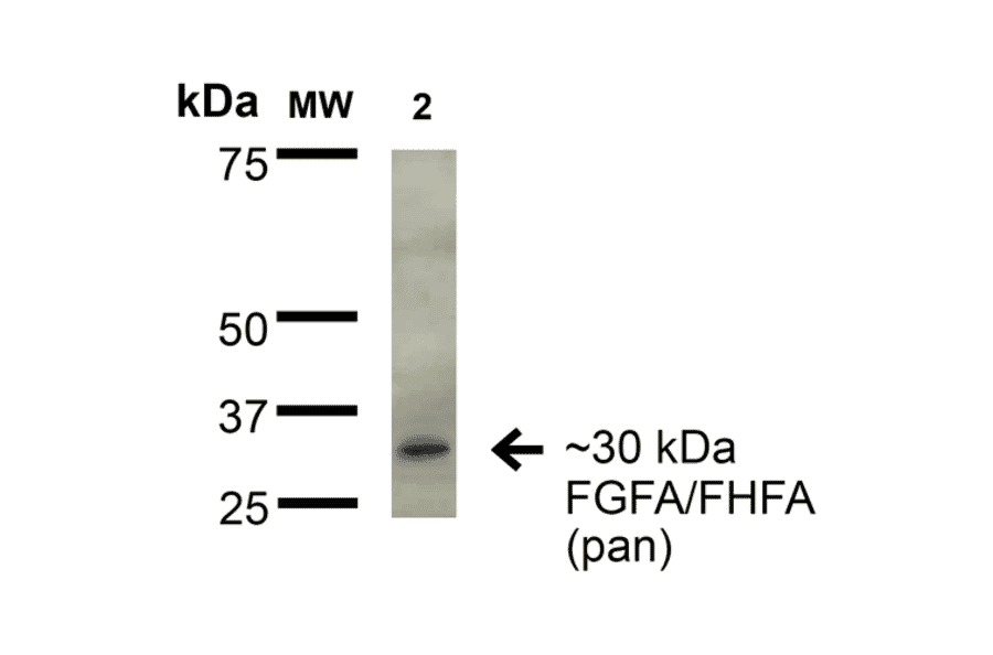 Western Blot - Anti-FGF13 Antibody [S235-22] (A304756) - Antibodies.com